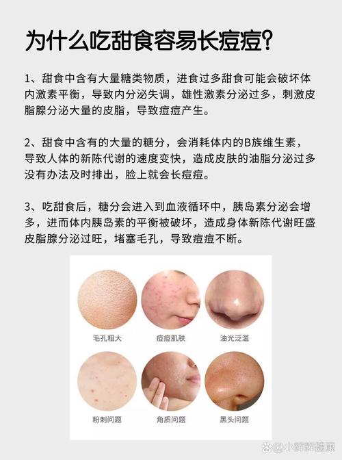 甘油會致痘嗎