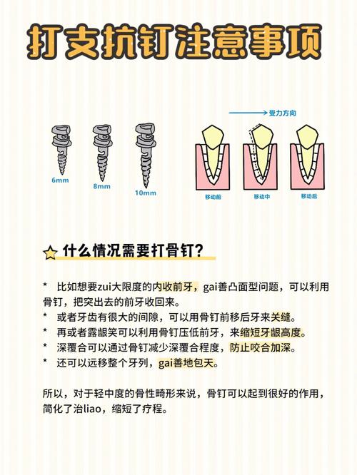 骨釘可以包軟蠟嗎