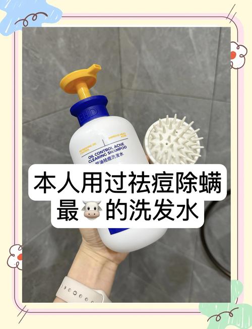 頭皮長痘痘跟洗髮精有關係嗎