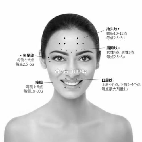 長痘痘可以打肉毒嗎