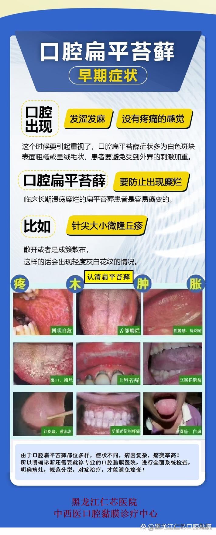 為什麼會有扁平苔蘚