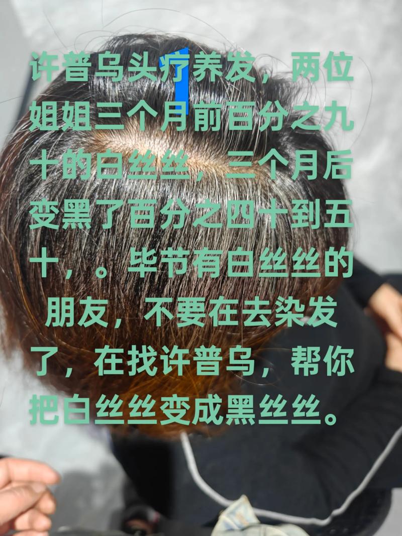 頭髮怎麼變白的?深度解析從科學原理到日常護理,告別「白髮蒼蒼」的困擾! 1 頭髮怎麼變白的
