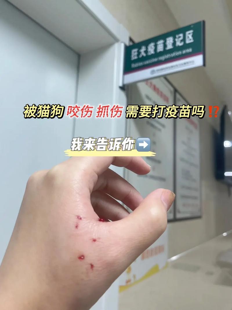 被貓抓傷要打破傷風嗎