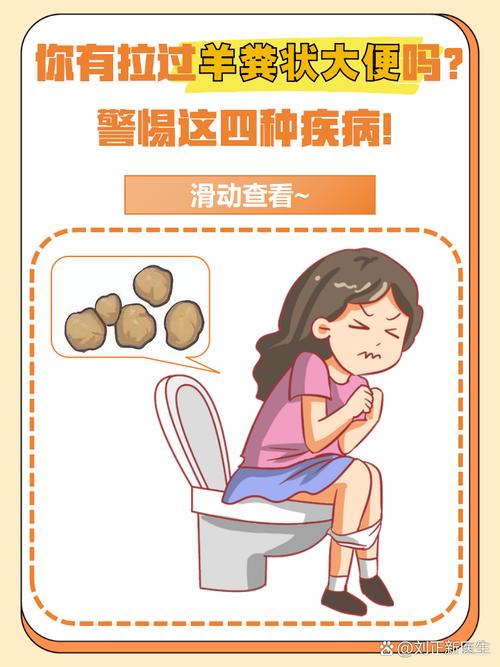 便秘是缺少什麼?深度解析便秘成因與解決之道 3 便秘是缺少什麼