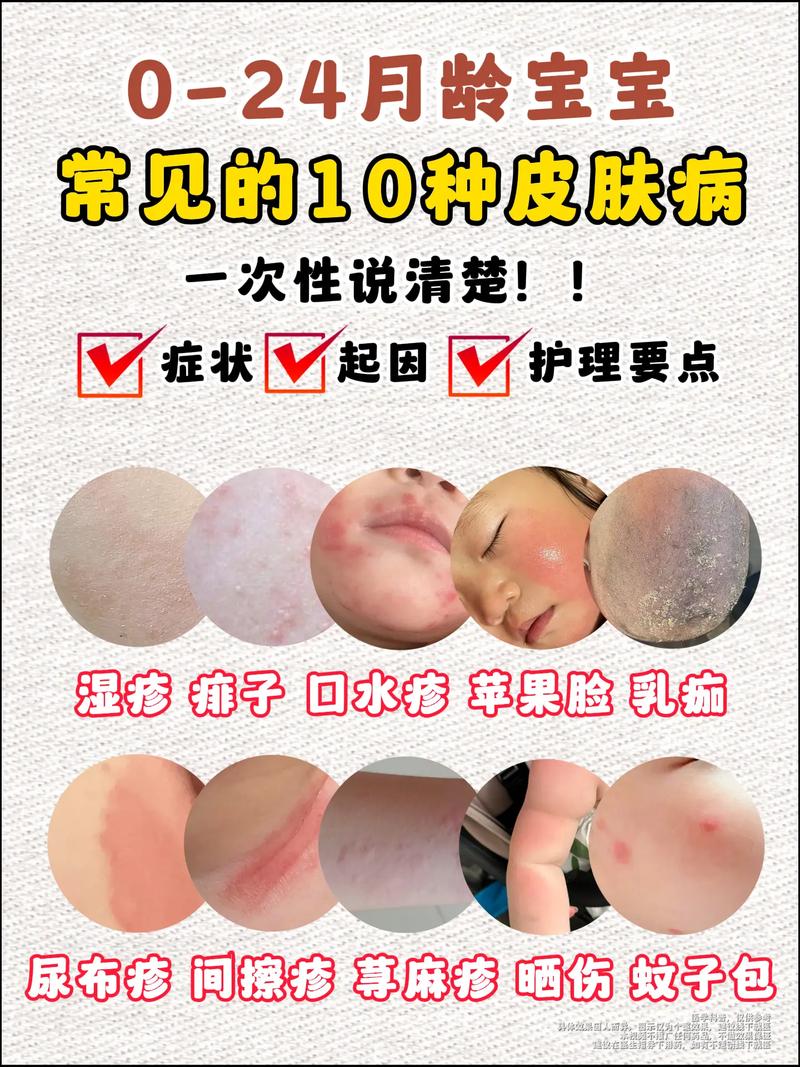 什麼是皮膚