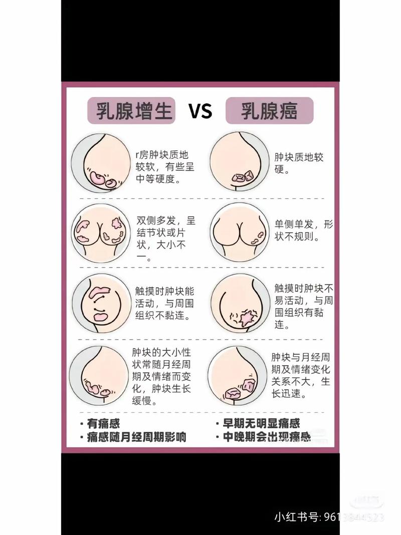 乳癌分幾種