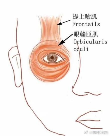 提眼瞼肌手術會痛嗎