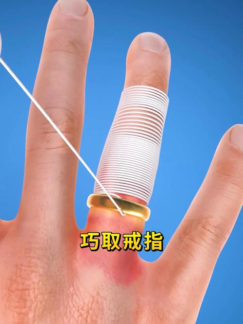 戒指怎麼拔出來