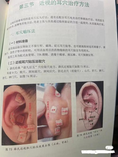 耳穴貼有效嗎