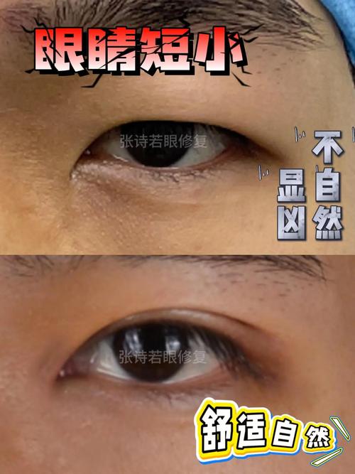 黑眼球怎麼變大