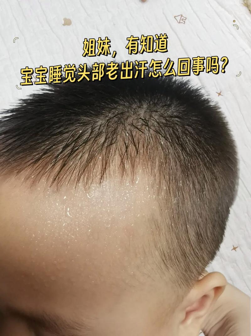為什麼小孩頭容易流汗