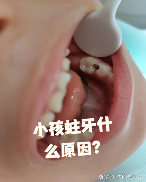 吃堅果會蛀牙嗎