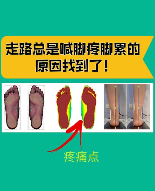 兒童腳痛看哪一科