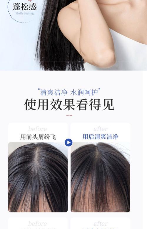 頭皮去角質多少錢