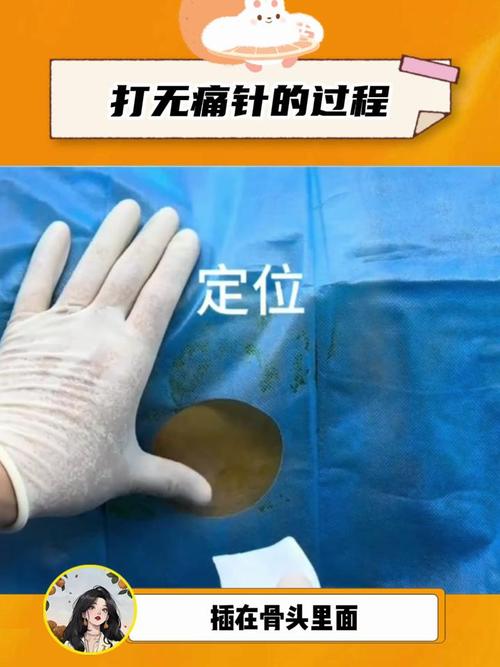 打軟針會痛嗎