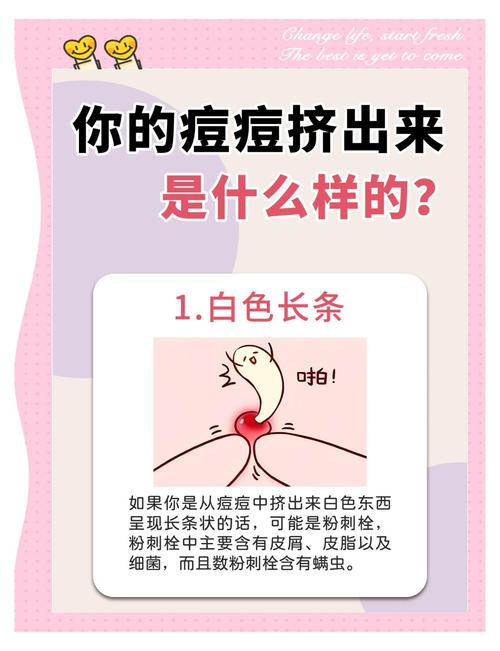 痘痘擠完還是凸凸的怎麼辦