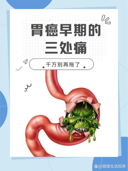 胃癌多久會死