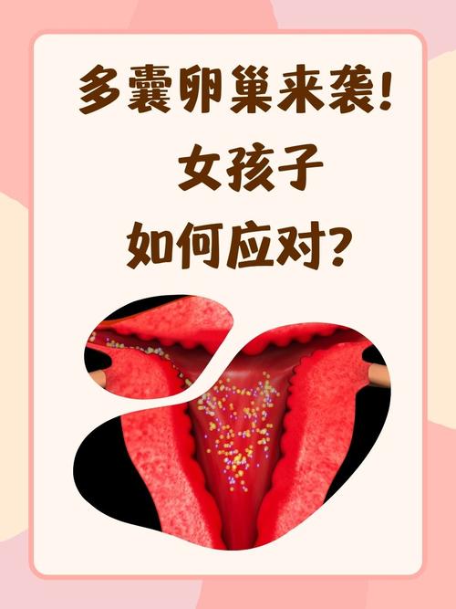 如何確定多囊