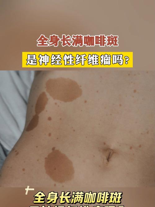 喝咖啡皮膚會變差嗎?深度解析咖啡因、肌膚健康與美麗肌膚的愛恨情仇 3 喝咖啡皮膚會變差嗎