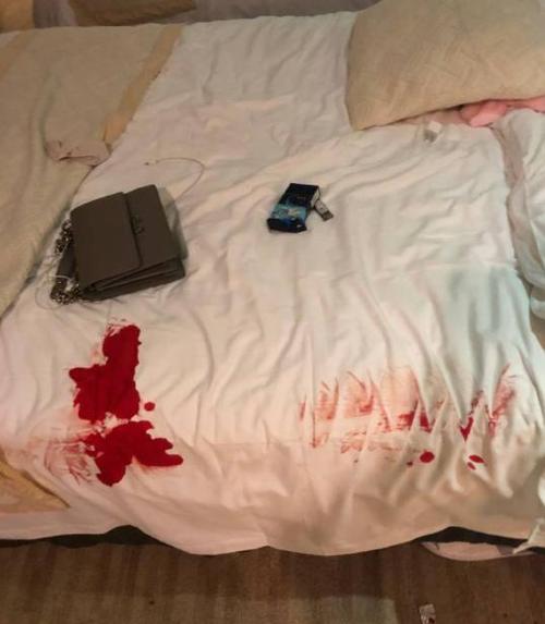 落紅多久會陣痛