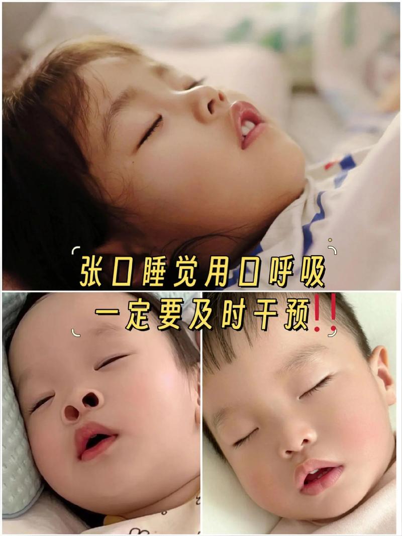 嘴巴張開睡覺會怎樣