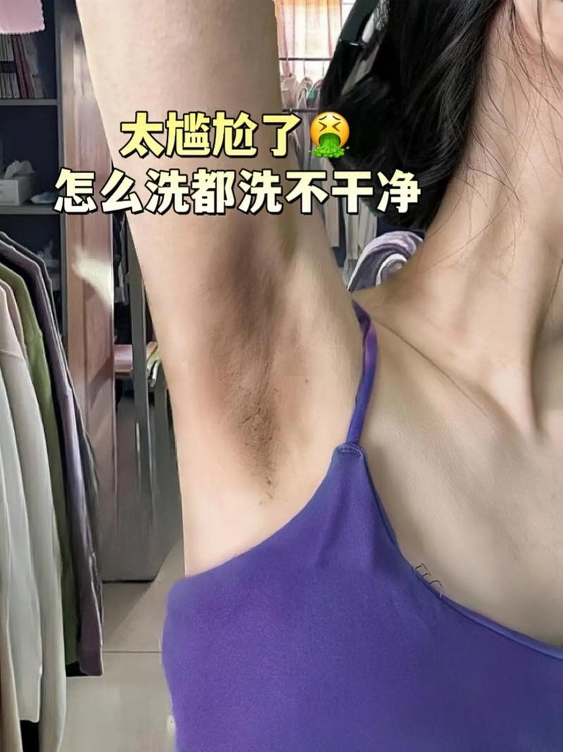 為什麼腋下會黑