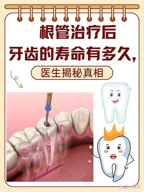 根管治療是什麼?深度解析牙齒的「起死回生術」:過程、費用、常見問題一次搞懂! 1 根管治療是什麼