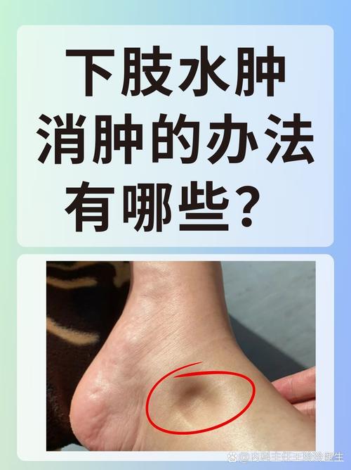 單腳水腫是什麼原因