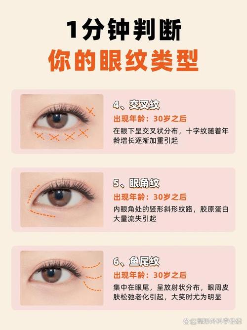 眼周細紋 幾歲