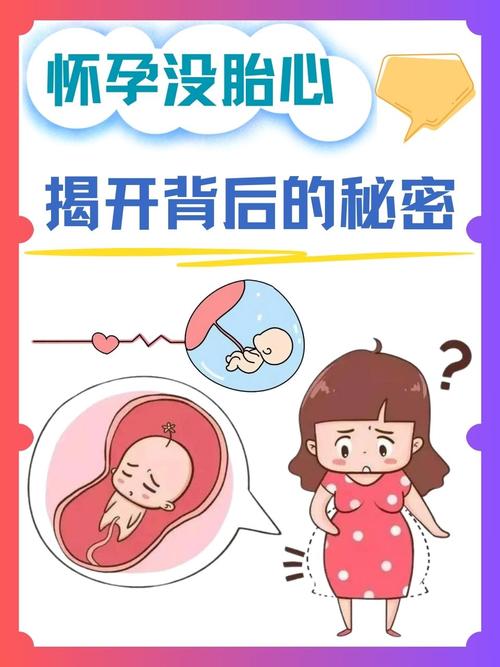 沒有胎動怎麼辦