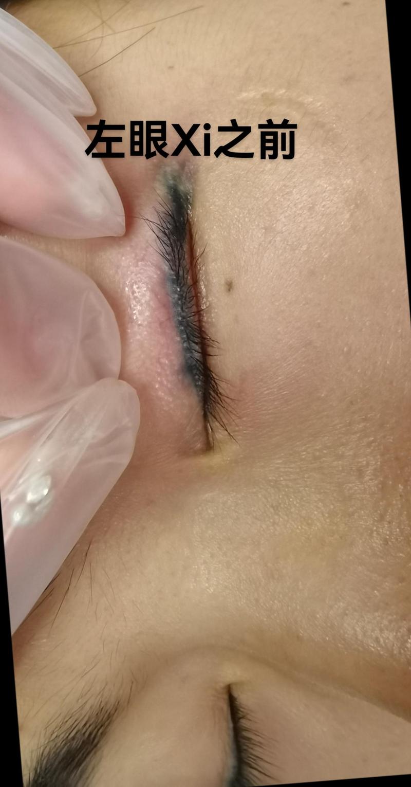 紋眼線副作用