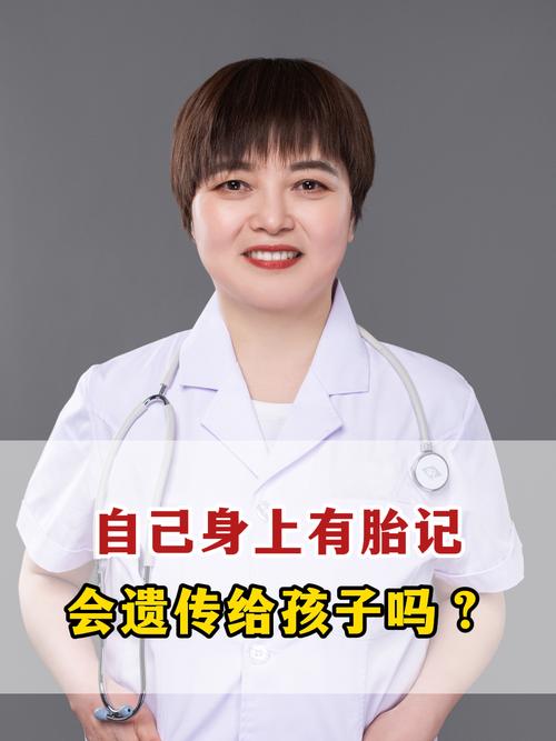 胎記是遺傳嗎