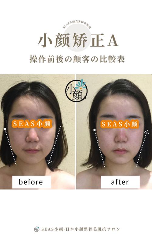 臉骨會變嗎