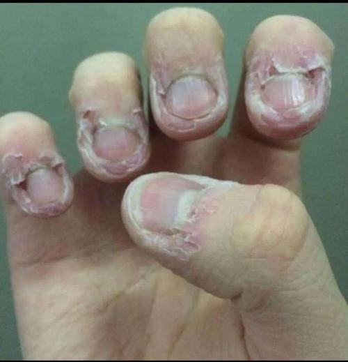 嬰兒指甲很髒怎麼辦