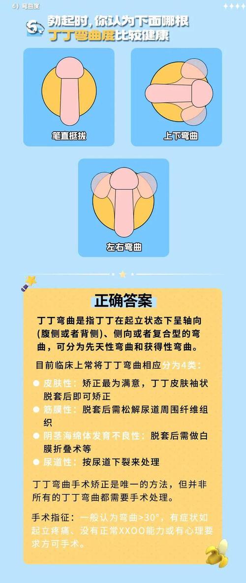 創世紀丁型是什麼