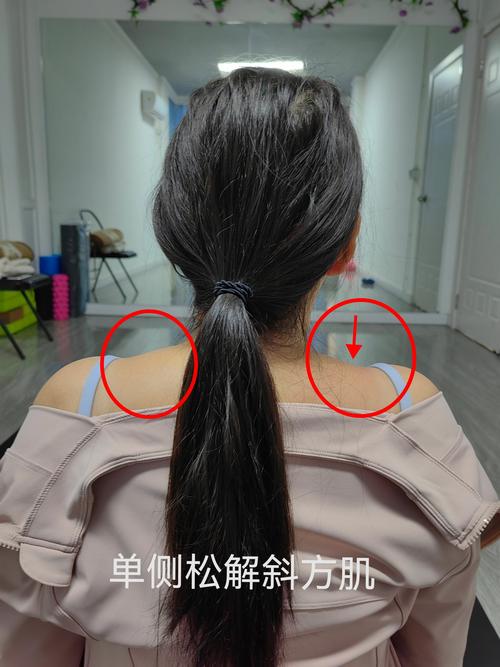 塑形片戴太久會怎樣