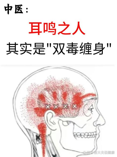 撞到頭會耳鳴嗎