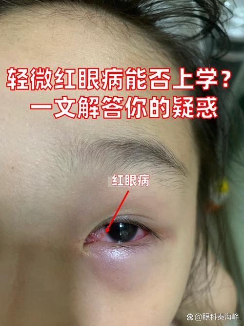 為什麼會眼紅