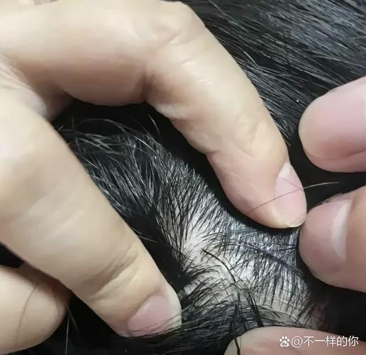右邊頭皮發麻