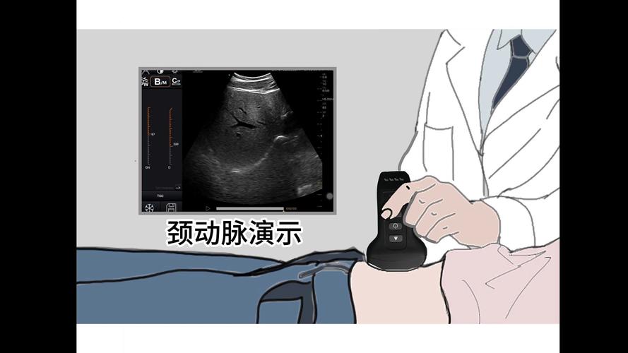 頸部超音波要看哪一科