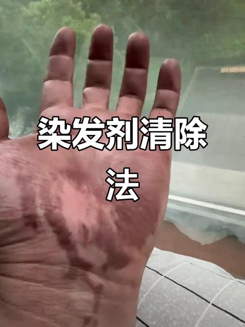 手用到染髮劑怎麼洗掉?不留痕跡的終極清潔指南與預防秘訣! 3 手用到染髮劑怎麼洗掉