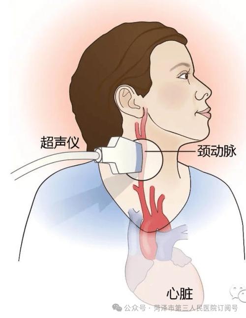 頸動脈會痛嗎