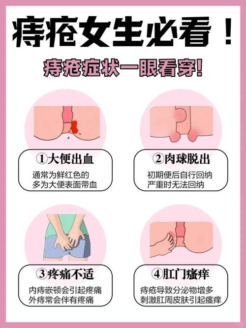 內痔一定要處理嗎