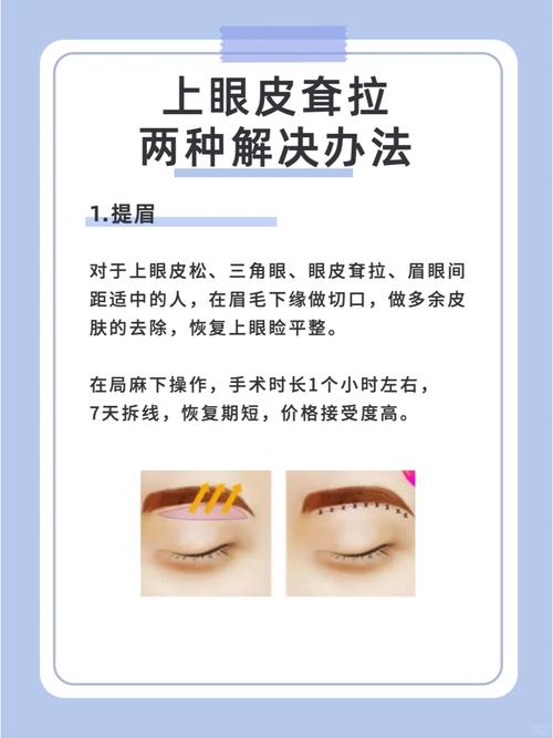 眼皮往下掉怎麼辦