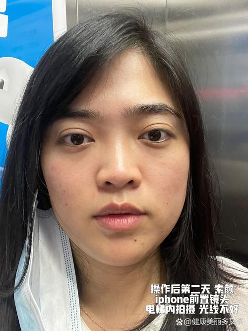 打完M22可以化妝嗎
