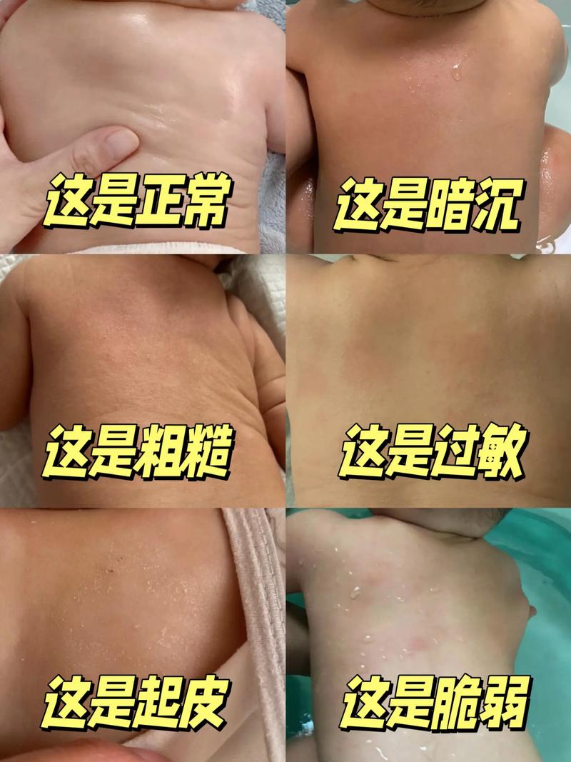 為什麼身體乳不能擦臉?深度解析臉部與身體肌膚的獨特需求 3 為什麼身體乳不能擦臉