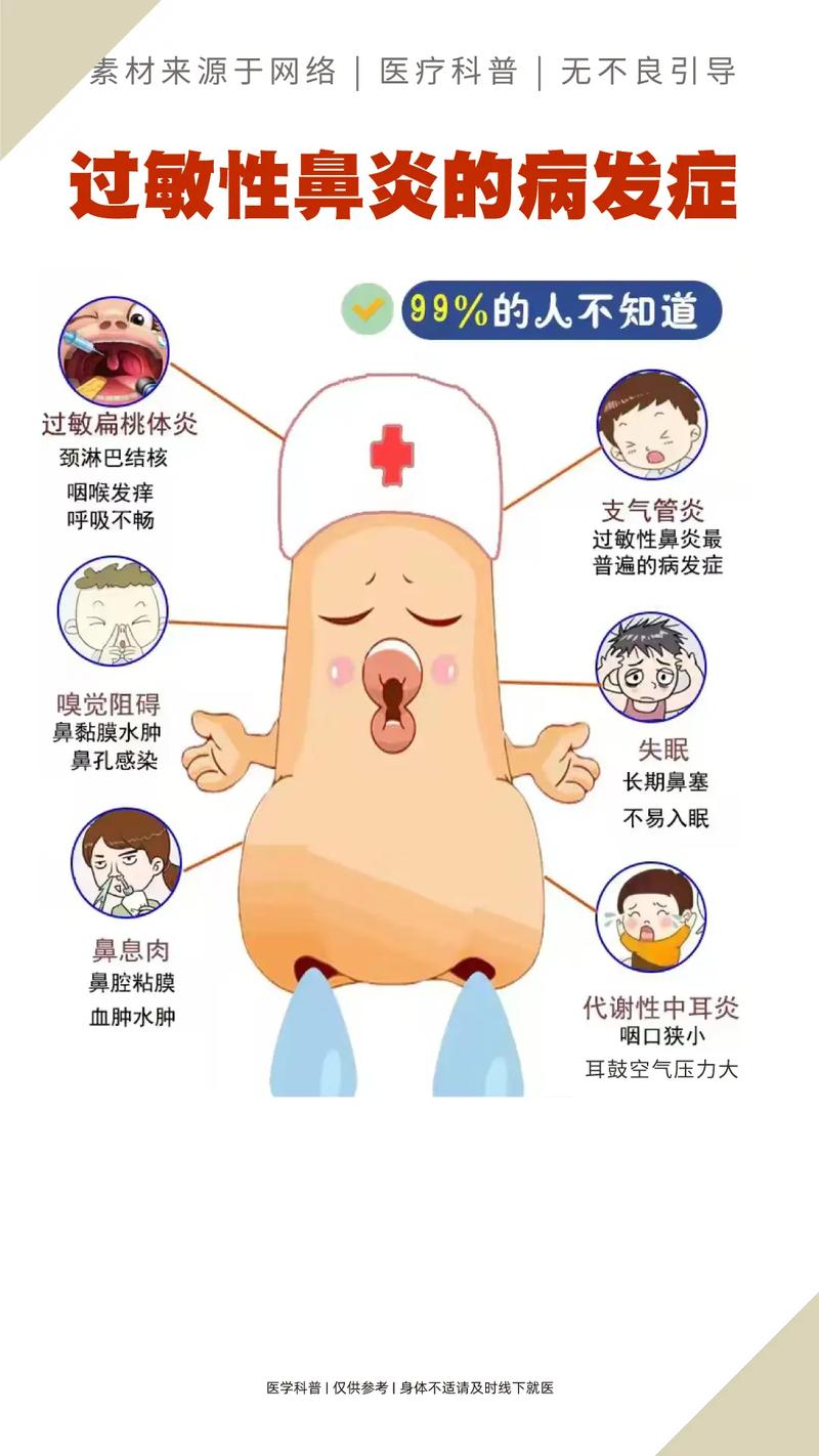 怎麼知道自己鼻子過敏