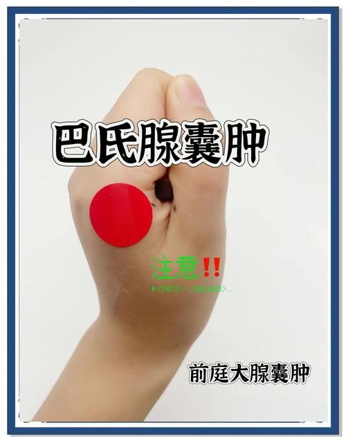 巴氏腺摸得到嗎