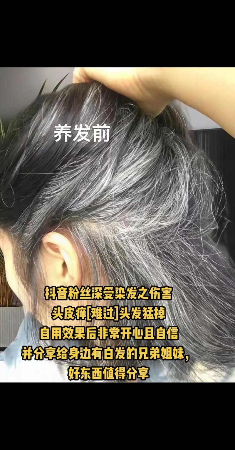 染髮過敏怎麼辦