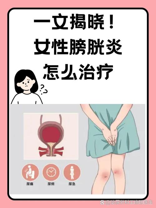 膀胱發炎是什麼感覺